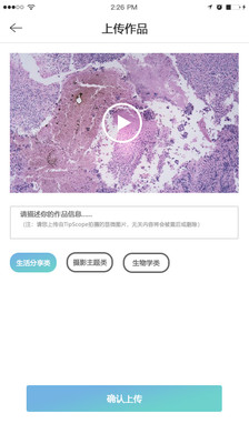 TipScope