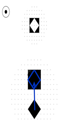 voi