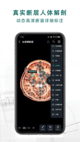 掌上3D解剖截图欣赏
