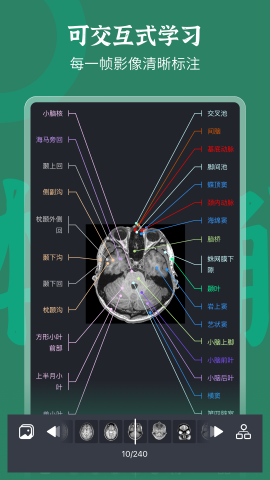 万康人体解剖截图欣赏