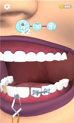 假牙医生游戏截图